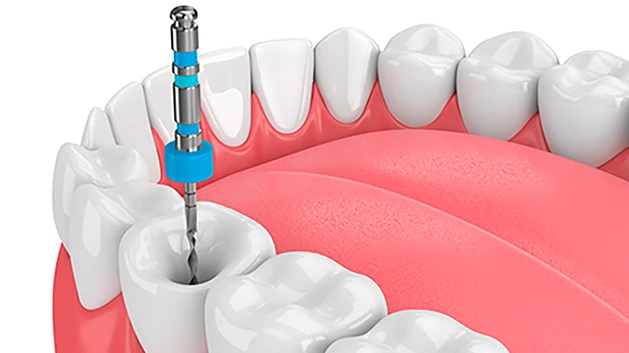 endodontia